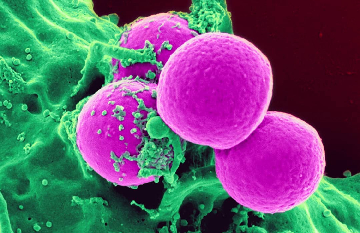 Staphylococcal enterotoxin B